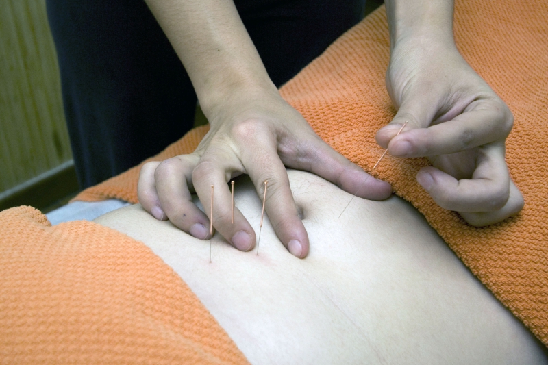 osteopathe-PUGET THENIERS-min_acupuncture-4175625